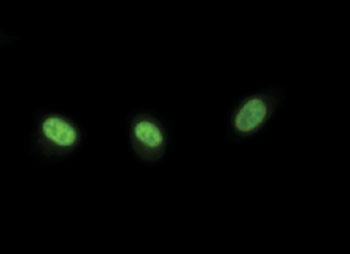 Image: Expression of RUNX2 in the nucleus of 1205LU melanoma cells (Photo courtesy of the Rutgers Cancer Institute).