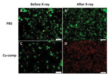 Image: X-ray destruction of human breast cancer cells using Cu-Cy particles. The images show the live cancer cells stained green and the dead cells stained red (Photo courtesy of Wei Chen/UT Arlington).