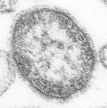 Image: Ultrastructural appearance of a single measles virus particle as revealed by thin-section transmission electron microscopy (TEM). It is 100–200 nm in diameter, with a core of single-stranded RNA, and is closely related to the rinderpest and canine distemper viruses (Photo courtesy of the CDC - [US] Centers for Disease Control and Prevention).