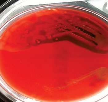 Штамм высокотоксичного метициллин-устойчивого золотистого стафилококка (MRSA) (вверху) и менее токсичный штамм (внизу), выращенные в чаше с кровяным агаром (фото любезно предоставлено Рутом Мэсси).