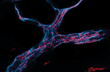 Image: MIT engineers designed RNA-carrying nanoparticles (red) that can be taken up by endothelial cells (stained blue) (Photo courtesy of Aude Thiriot, Harvard University).