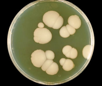 Image: Colonies of the fungus Candida albicans growing on Sabouraud agar after 48 hours. This fungus may overwhelm other cultured microorganisms within two days (Photo courtesy of Dr. William Kaplan).