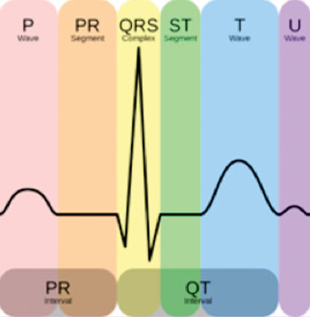 Image: Normal ECG/EKG complex with labels (Photo courtesy of Wikimedia Commons).