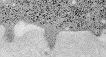 Image: Electron micrograph shows a cancer cell (upper darker area) that has formed three invadopodia that are penetrating the adjacent extracellular matrix (lower lighter area) (Photo courtesy of Yeshiva University).