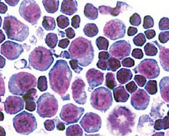 Image: A microscopic image of erythroblasts which are the bone marrow cells that secrete erythroferrone (Photo courtesy of UCLA - University of California, Los Angeles).