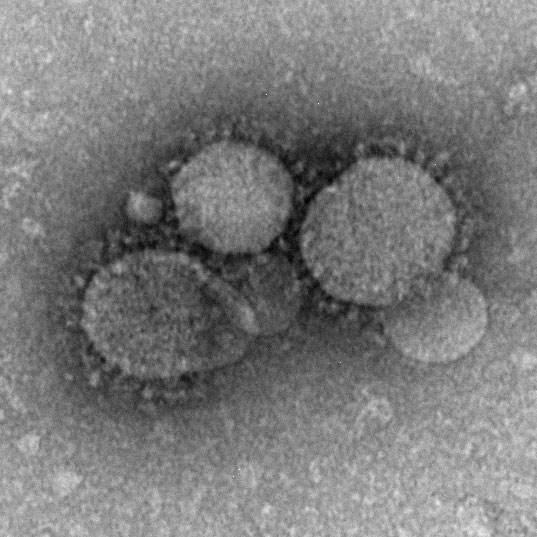 Image: MERS-CoV electron micrograph: MERS-CoV particles as seen by negative stain electron microscopy. Virions contain characteristic club-like projections emanating from the viral membrane (Photo courtesy of Wikipedia Commons).