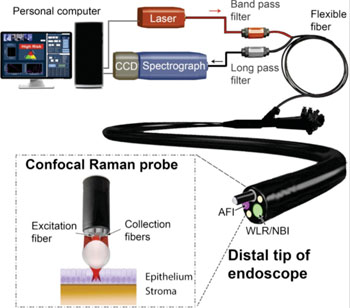 Image: Rapid fiber-optic confocal Raman spectroscopy system developed for real-time in vivo epithelial tissue diagnosis and characterization during endoscopy (Photo courtesy of Prof. Zhiwei Huang, the National University of Singapore, and the journal Gastroenterology).