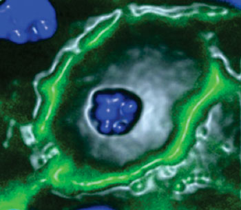Image: The transporter GLUT8 (green) is in the outer membrane of liver cells. In mice, blocking GLUT8 stops fructose from entering the liver and protects against nonalcoholic fatty liver disease. The liver cell nuclei are shown in blue (Photo courtesy of Dr. Brian J. DeBosch, Washington University School of Medicine).