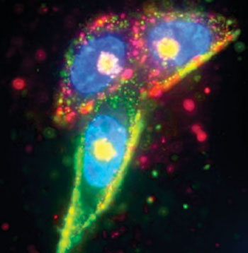 Image: Prostate cancer cells were targeted by two separate silver nanoparticles (red and green), while the cell nucleus was labeled in blue using Hoescht dye (Photo courtesy of UCSB – University of California, Santa Barbara).