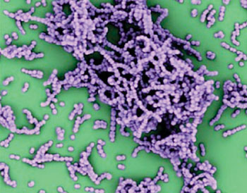 Image: Electron micrograph, false color, of group A Streptococcus bacteria (Photo courtesy of the University of California, San Diego).