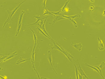 Image: Human bone marrow derived mesenchymal stem cell after three weeks of culture showing fibroblast like morphology seen under phase contrast microscope at 63x magnification (Photo courtesy of Wikimedia Commons).