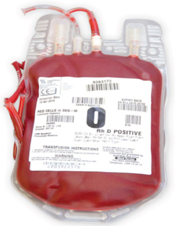 Image: Red blood cell transfusion pack (Photo courtesy of Australian Red Cross).