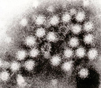 Image: Transmission electron micrograph of Norovirus particles in feces (Photo courtesy of Graham Colm).