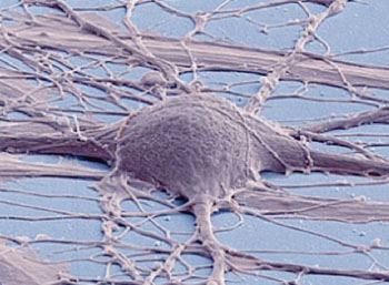 Image: Scanning electron micrograph of cultured human neuron from induced pluripotent stem cell (Photo courtesy of the University of California, San Diego).