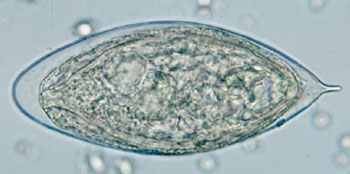 Image: Egg of Schistosoma haematobium in a wet mount of urine concentrates, showing the characteristic terminal spine (Photo courtesy of the Centers of Disease Control and Prevention).
