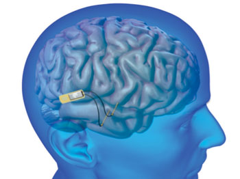 Image: Lawrence Livermore National Laboratory (LLNL) will develop an implantable neural device with the ability to record and stimulate neurons within the brain to help restore memory (Photo courtesy of DOE/Lawrence Livermore National Laboratory).