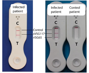 Image: The Lateral flow test for human African trypanosomiasis using a single-antigen (sVSG117) prototype (left)  and a dual-antigen prototype developed with infection serum and control uninfected serum (right) (Photo courtesy of University of Dundee).