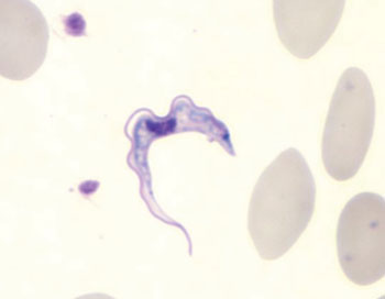 Image: Photomicrograph a Trypanosoma brucei gambiense found in a Giemsa-stained blood smear (Photo courtesy of Blaine Mathison).
