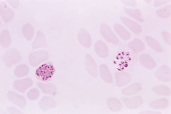 Image: Photomicrograph of a thin film blood smear reveals the presence of two Plasmodium vivax schizonts, an immature form on the left, and a mature form on the right (Photo courtesy of Dr. Mae Melvin).