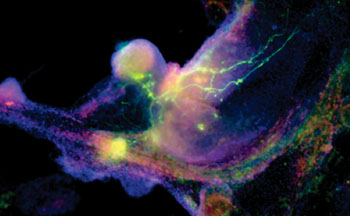 Image: Induced pluripotent stem cells—known as iPS cells, and which act very much like embryonic stem cells—are here growing into heart cells (blue) and nerve cells (green) (Photo courtesy of the Gladstone Institutes/Chris Goodfellow).