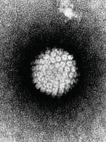 Image: Electron micrograph of human papillomavirus (HPV) (Photo courtesy of the [US] National Institutes of Health).