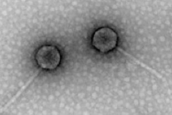 Image: Electron microscopy image of the bacteriophages investigated (Photo courtesy of the European Molecular Biology Laboratory).