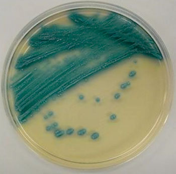 Image: Typical colonies of methicillin-resistant Staphylococcus aureus (MRSA) grew and formed blue-colored colonies on MRSA-chrom media after 24 hours of incubation at 35 °C (Photo courtesy of Kohjin Bio Co., Ltd).