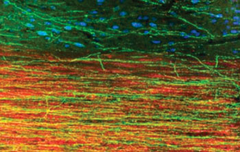 Image: Extension of human axons into host adult rat white matter and gray matter three months after spinal cord injury and transplantation of human induced pluripotent stem cell-derived neurons. Green fluorescent protein identifies human graft-derived axons, myelin (red) indicates host rat spinal cord white matter and blue marks host rat gray matter (Photo courtesy of UCSD – University of California, San Diego School of Medicine).