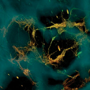 Image: Neurons (greenish yellow) attach to silk-based scaffold (blue) creating functional networks throughout the scaffold pores (dark areas) (Photo courtesy of Tufts University).