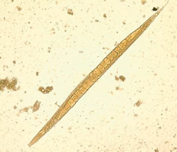 Image: The adult free-living female Strongyloides stercoralis with a row of eggs within the body of the nematode (Photo courtesy of the CDC - Centers for Disease Control and Prevention).