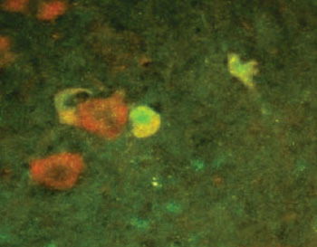 Image: The presence of p45 (green staining) and p75 (red staining) indicates that motor neurons increase both p45 and p75 expression after sciatic nerve injury in an animal (Photo courtesy of the Salk Institute for Biological Studies).