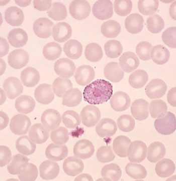 Image: Blood smear showing a male gametocyte of Plasmodium vivax (Photo courtesy of Dr. Mae Melvin).