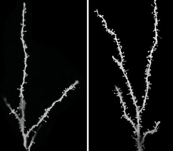 Image: (Left) Neurons in brains from people with autism do not undergo normal pruning during childhood and adolescence. The images show representative neurons from unaffected brains (left) and brains from autistic patients (right); the spines on the neurons indicate the location of synapses (Photo courtesy of Guomei Tang, PhD and Mark S. Sonders, PhD, Columbia University Medical Center).