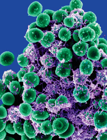 Image: Scanning electron micrograph of Staphylococcus epidermidis, the commonest coagulase-negative staphylococci found on the skin (Photo courtesy of the US National Institute of Allergy and Infectious Diseases).