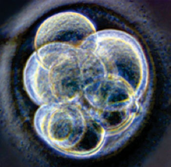 Image: Cloned hair cells (Photo courtesy of Hair Loss Specialists, Evanston, IL, USA).