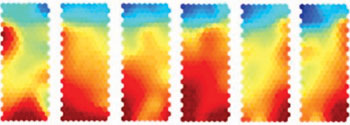 Image: Aggressor cells, which have the potential to cause autoimmunity, are targeted by treatment, causing conversion of these cells to protector cells. Gene expression changes gradually at each stage of treatment, as illustrated by the color changes in this series of heat maps (Photo courtesy of the University of Bristol/Dr. Bronwen Burton).