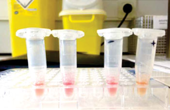 Image: The modified Carba NP test for detecting carbapenem-resistant Enterobacteriaceae. The test is validated by yellow color for positive (+) and red for negative (-) (Photo courtesy of Dr. Patrice Nordmann).