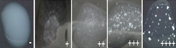 Image: The agglutination latex assay for enteropathogenic and enterohemorrhagic Escherichia coli; negative (-) and a semi-quantitative positive (from + to ++++) agglutination pattern with anti-EspB monoclonal coated beads (Photo courtesy of Instituto Butantan).