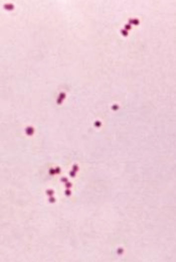 Image: This micrograph depicts the presence of aerobic Gram-negative Neisseria meningitidis diplococcal bacteria; magnification 1150x (Photo courtesy of the CDC - US Centers for Disease Control and Prevention).