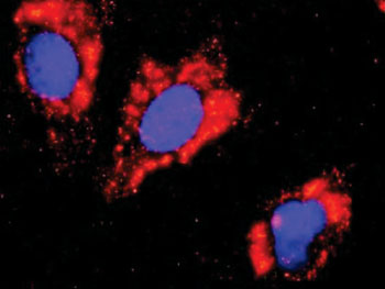 Image: A fluorescent proximity ligation assay of protein-protein interactions (Photo courtesy of Abnova).