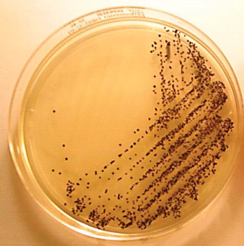 Image: Culture of Clostridium difficile from a stool sample after 24 hours of incubation on chromogenic medium forming typical black colonies (Photo courtesy of the Freeman Hospital).