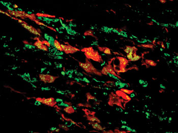 Image: Fibroblasts (red) express endothelial markers (green), making the heart cells in mice appear yellow. The green blood vessels running horizontally are partly composed of red/yellow cells, suggesting that fibroblasts are incorporated into blood vessels (Photo courtesy of UNC – University of North Carolina).