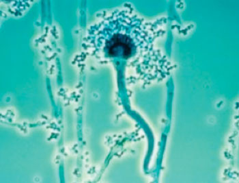 Image: Conidiophores of Aspergillus fumigatus (Photo courtesy of the CDC - [US] Centers for Disease Control and Prevention).