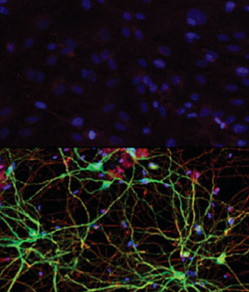 Image: Human skin cells (top) can be converted into medium spiny neurons (bottom) with exposure to the right combination of microRNAs and transcription factors, according to work by Andrew Yoo and his research team (Photo courtesy of Washington University School of Medicine in St. Louis).