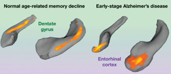 Image: The dentate gyrus is distinct from the entorhinal cortex, the hippocampal region affected in early-stage Alzheimer’s disease. Previous work, including by the laboratory of senior author Scott A. Small, MD, had shown that changes in a specific part of the brain’s hippocampus—the dentate gyrus—are associated with normal age-related memory decline in humans and other mammals (Photo courtesy of Columbia University Medical Center).