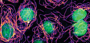 Image: Cells with damage in their DNA (green) assemble abnormally stable microtubule structures (purple to white). This new link between microtubule control and the response to DNA damage, originally discovered in yeast, can be observed also in human cells (shown) (Photo courtesy of L. Wagstaff, E. Piddini).