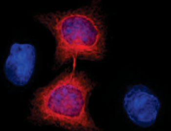 Image: On target: When researchers introduced nanobodies they made to cells engineered to express a tagged version of a protein in skeletal fibers known as tubulin (red), the nanobodies latched on. The cells above have recently divided (Photo courtesy of Rockefeller University).