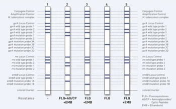 Image: The GenoType MTBDRsl rapid test to diagnose patients with multidrug resistant tuberculosis (MDR-TB) also provides information on further antibiotic resistances (Photo courtesy of Hain Lifescience).