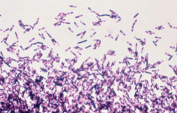 Image: Clostridium difficile (shown here) is a bacterium in the intestines that has been successfully treated through microbiome manipulation (Photo courtesy of the CDC - [US] Centers for Disease Control and Prevention).