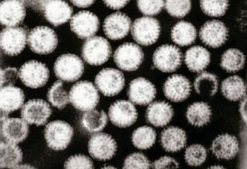 Image: Transmission electron micrograph of multiple rotavirus particles in the feces of an infected child. Each one is about 70 nanometers in diameter (Photo courtesy of Wikimedia Commons).